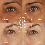 Before and after close-ups showing reduced wrinkles and firmer skin around eyes using Hydro Cool Firming Eye Gels in 10.