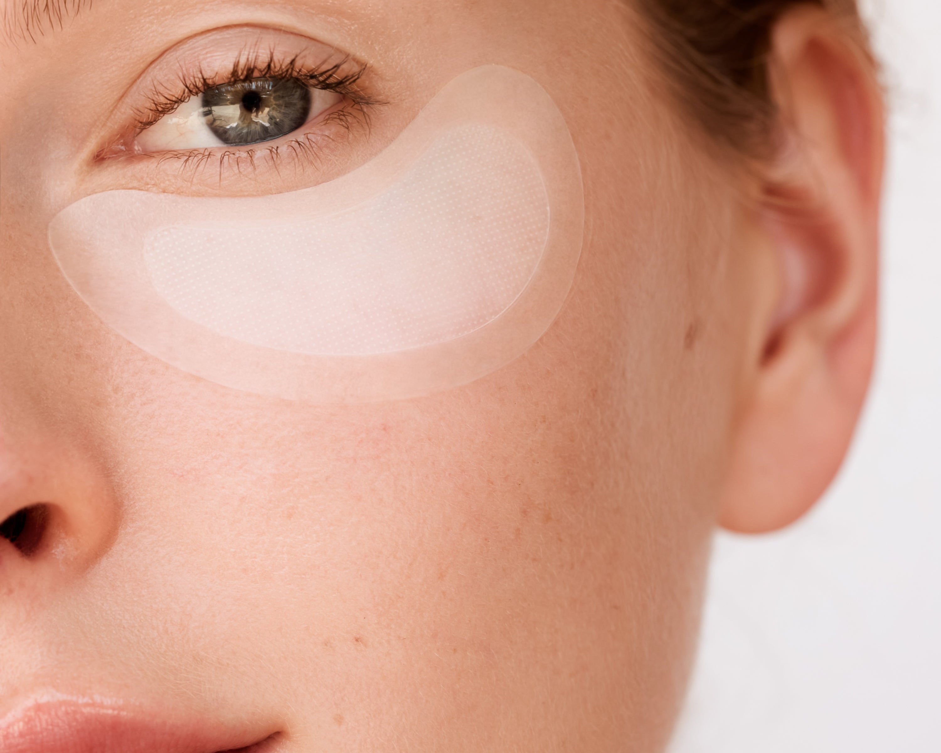 Which Dissolving Patches Work Best for Crow’s Feet? A Real-World Comparison