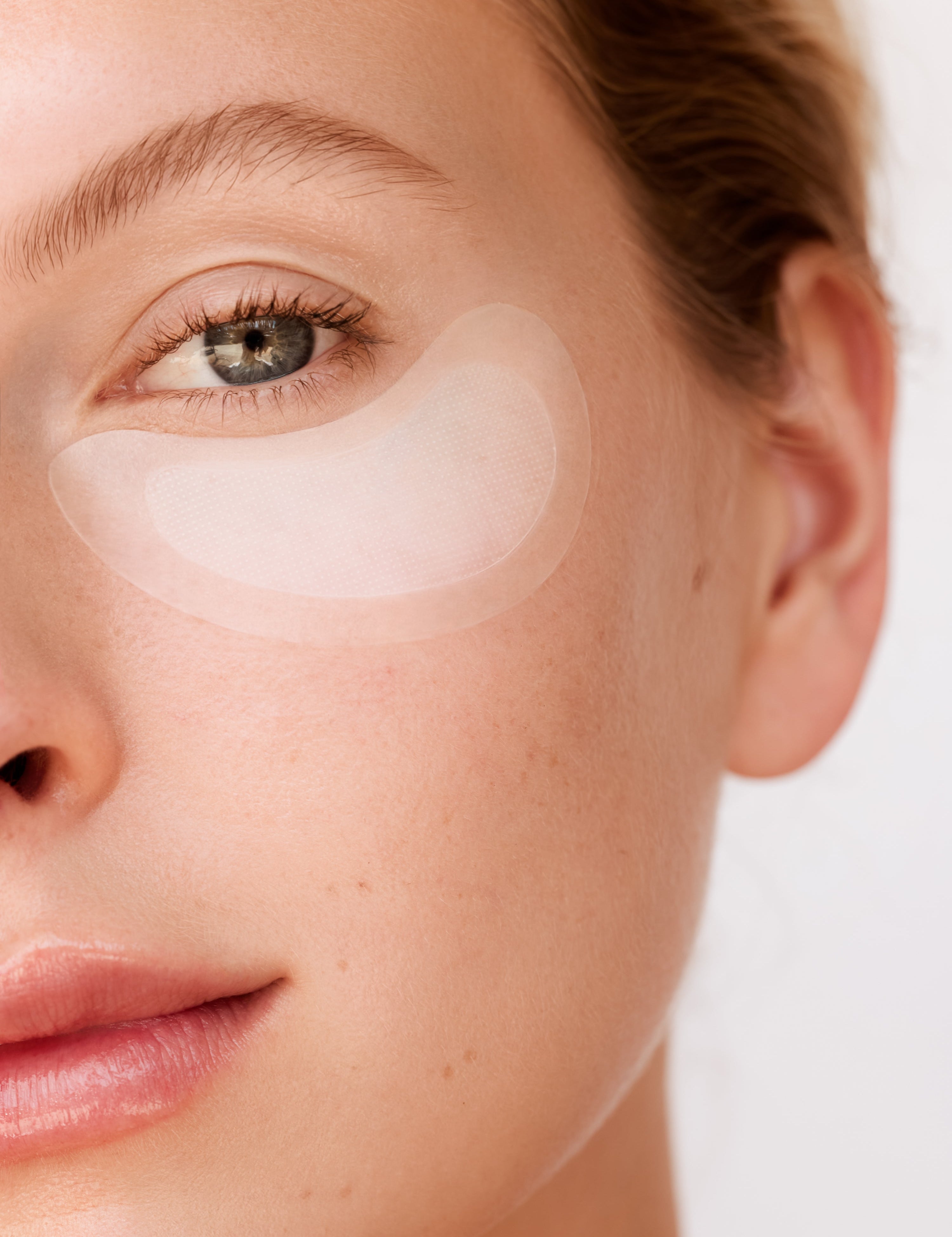 Which Dissolving Patches Work Best for Crow’s Feet? A Real-World Comparison