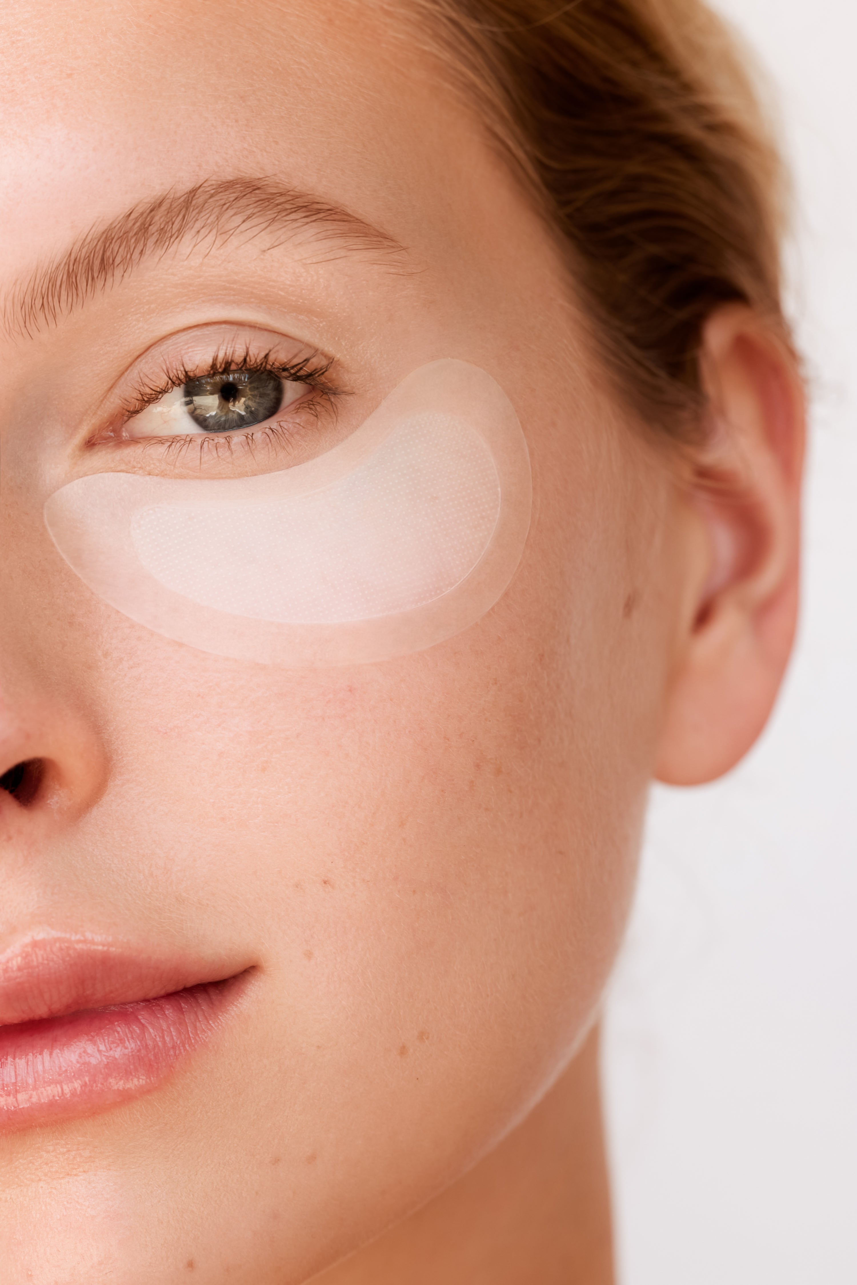 Which Dissolving Patches Work Best for Crow’s Feet? A Real-World Comparison