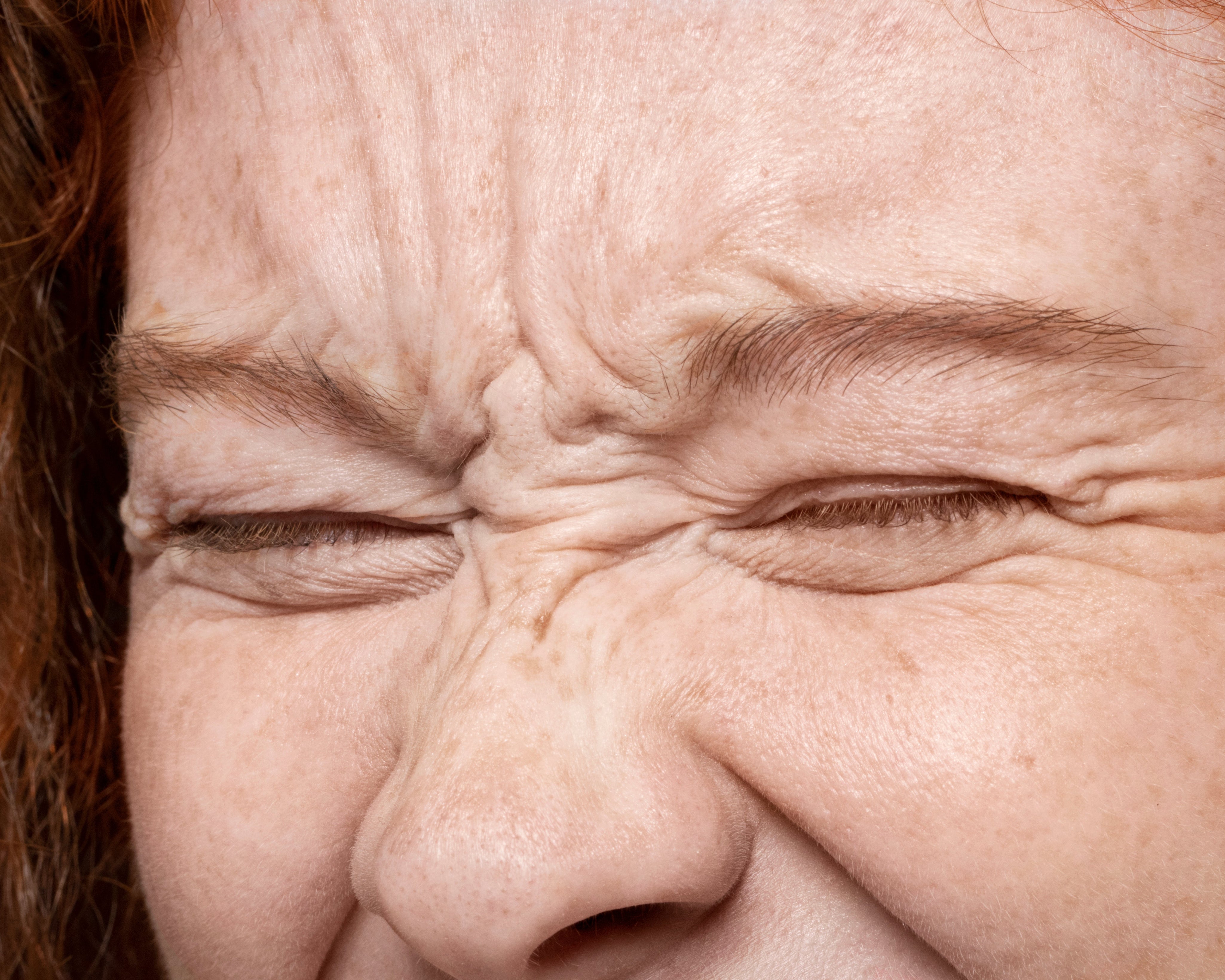 Are You Seeing Stress Wrinkles? Here’s the Dermatologist-Approved Solution