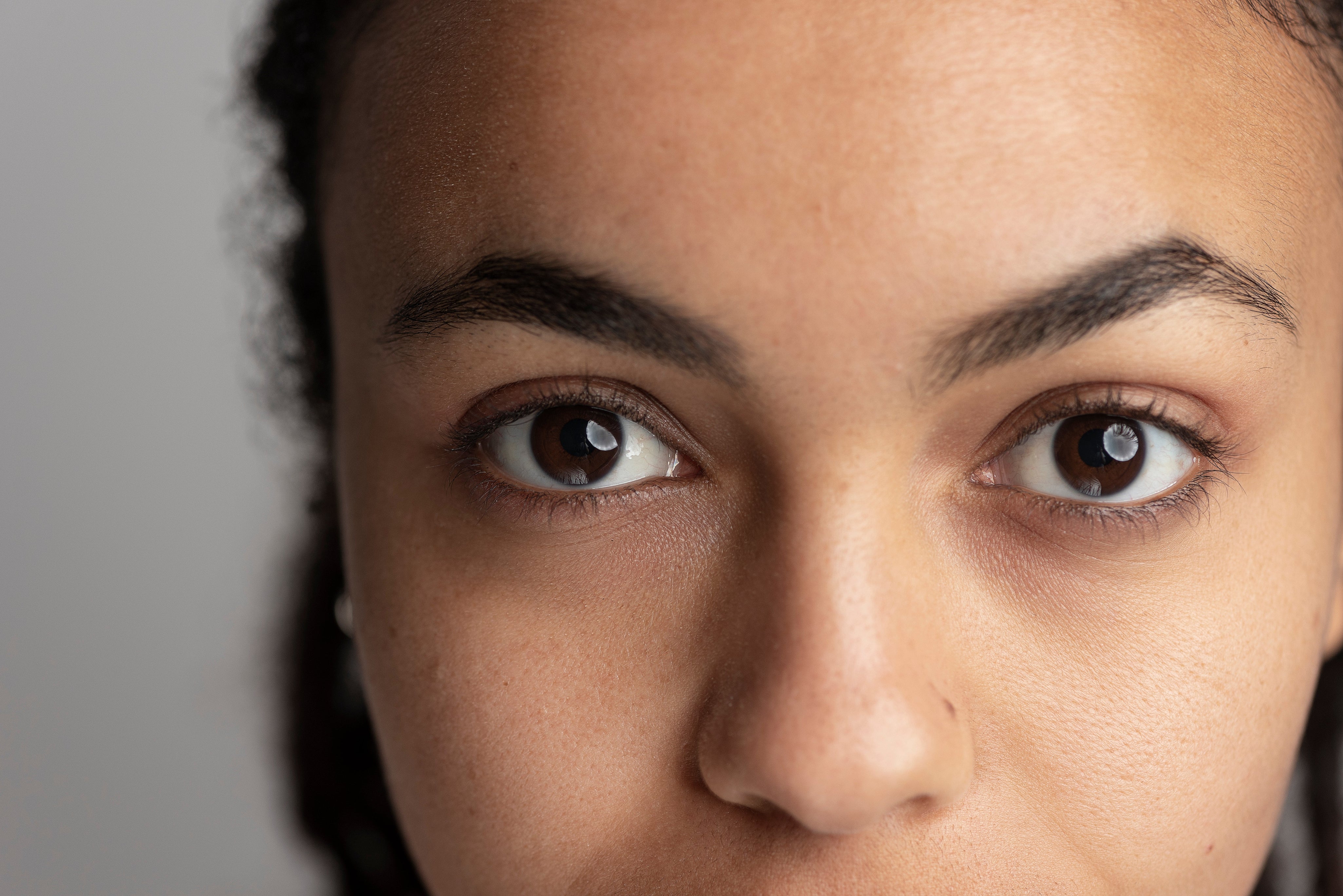 How to Remove Dark Circles Caused by Stress: Expert Tips and Skyn Iceland Solutions