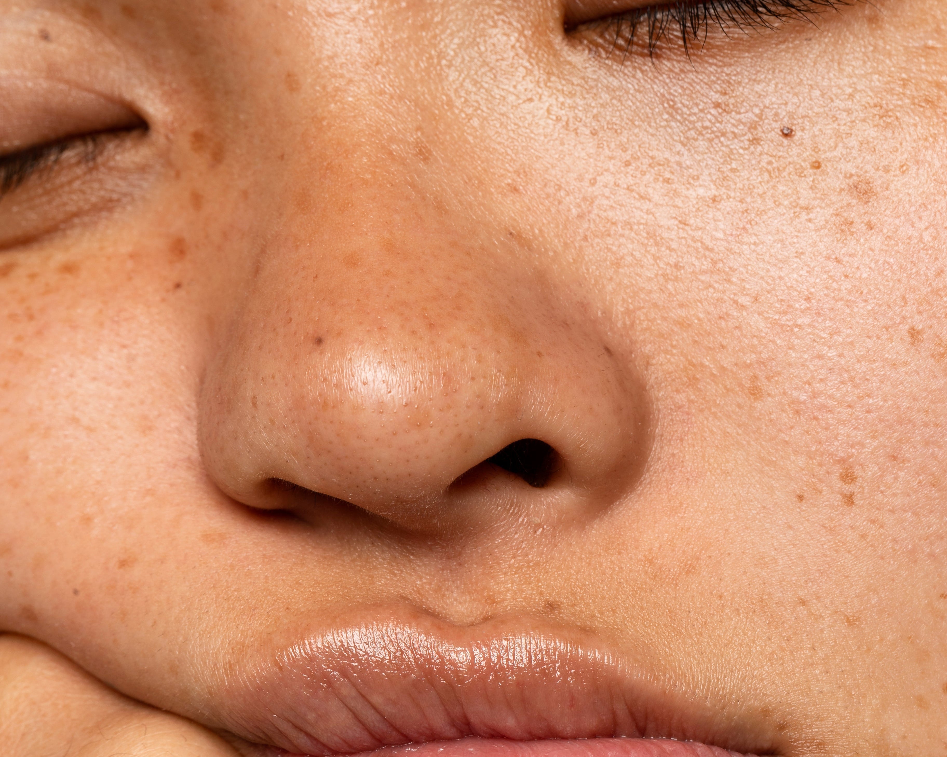 The Rise of 'Zombie Cells': How Cellular Senescence Ages Your Skin (And How to Stop It)
