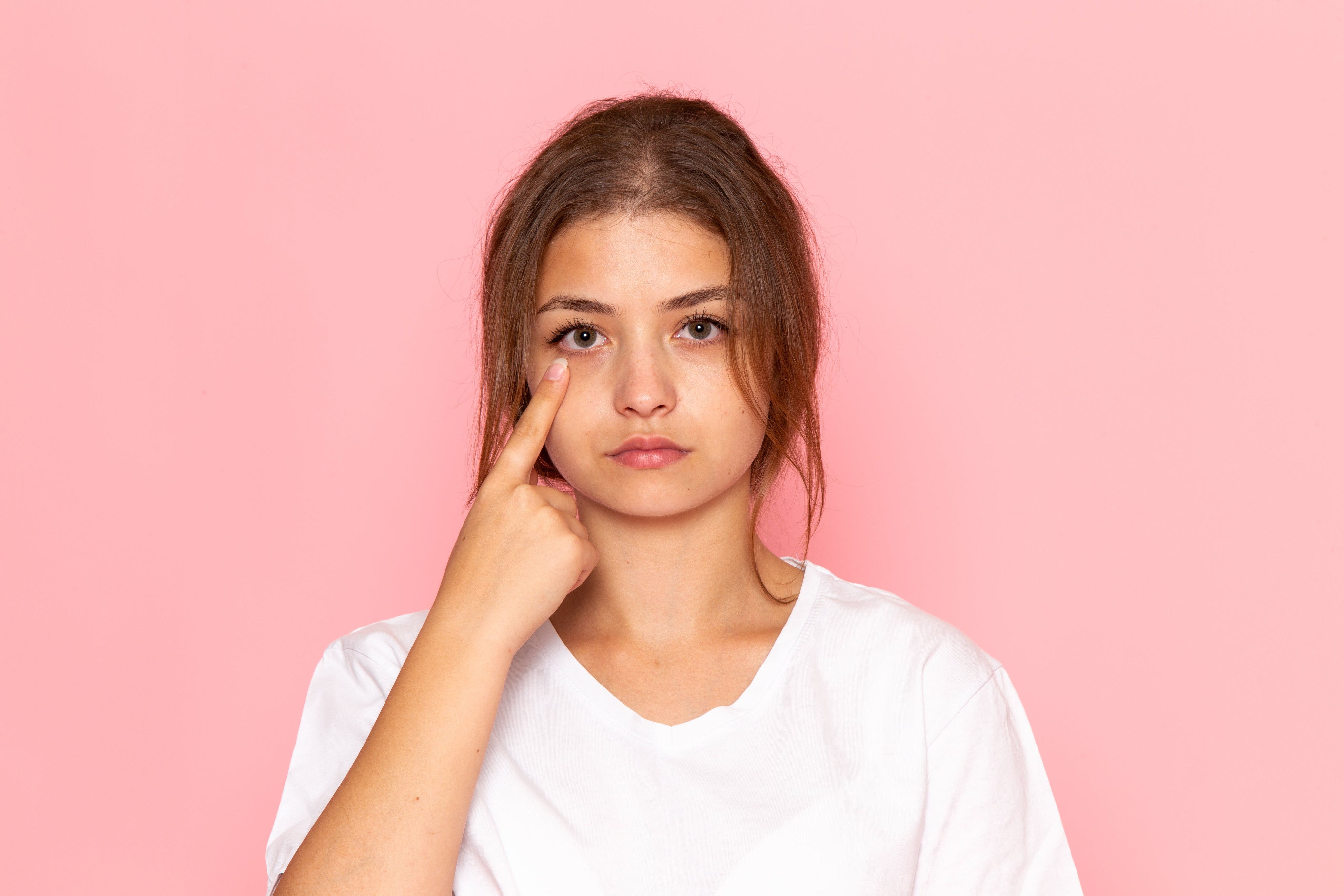 Why the Eye Area Is the First Indicator of Systemic Stress – Skyn ICELAND
