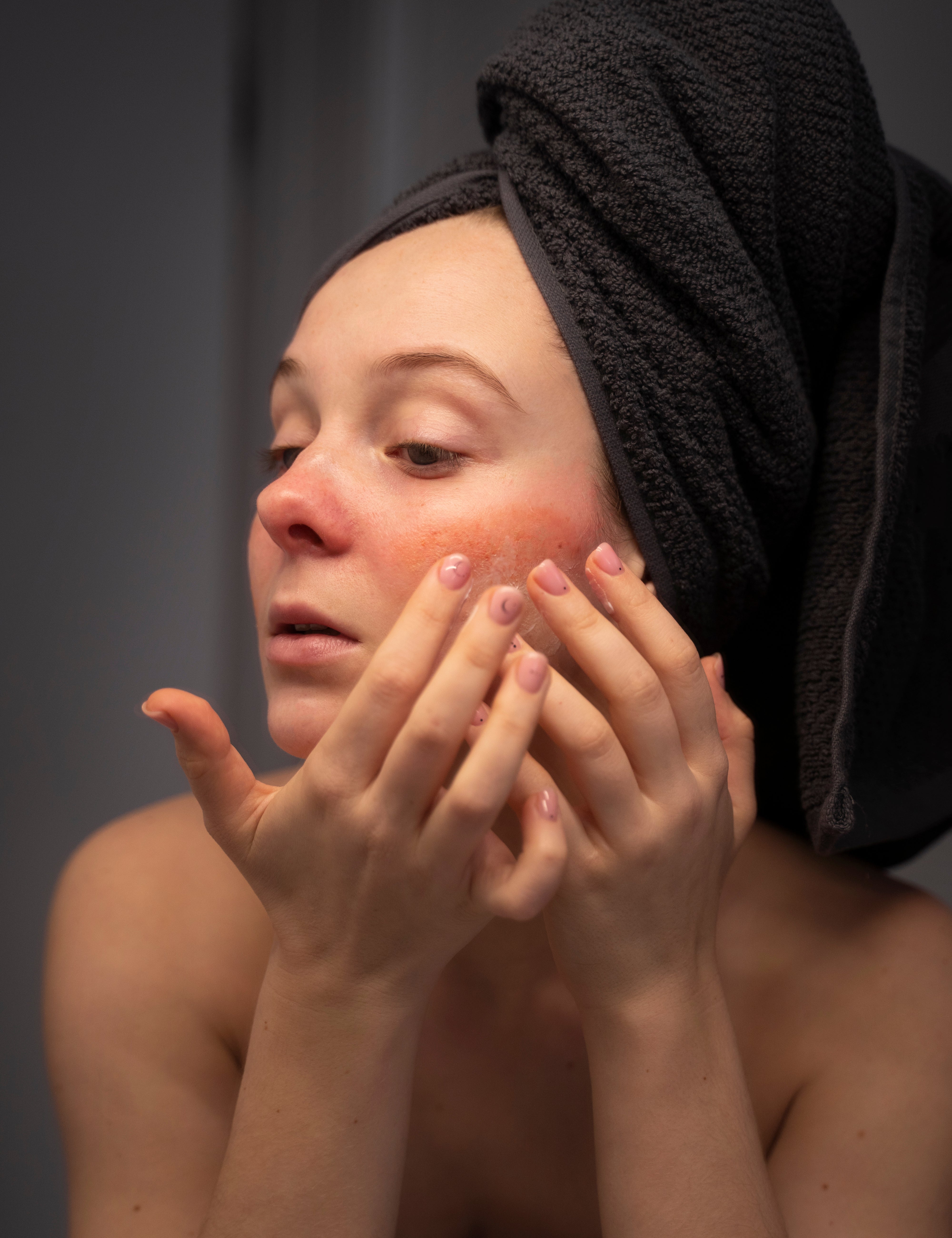 How to Soothe Dry Patches on Your Face in Winter: Expert Tips and Skyn Iceland Solutions