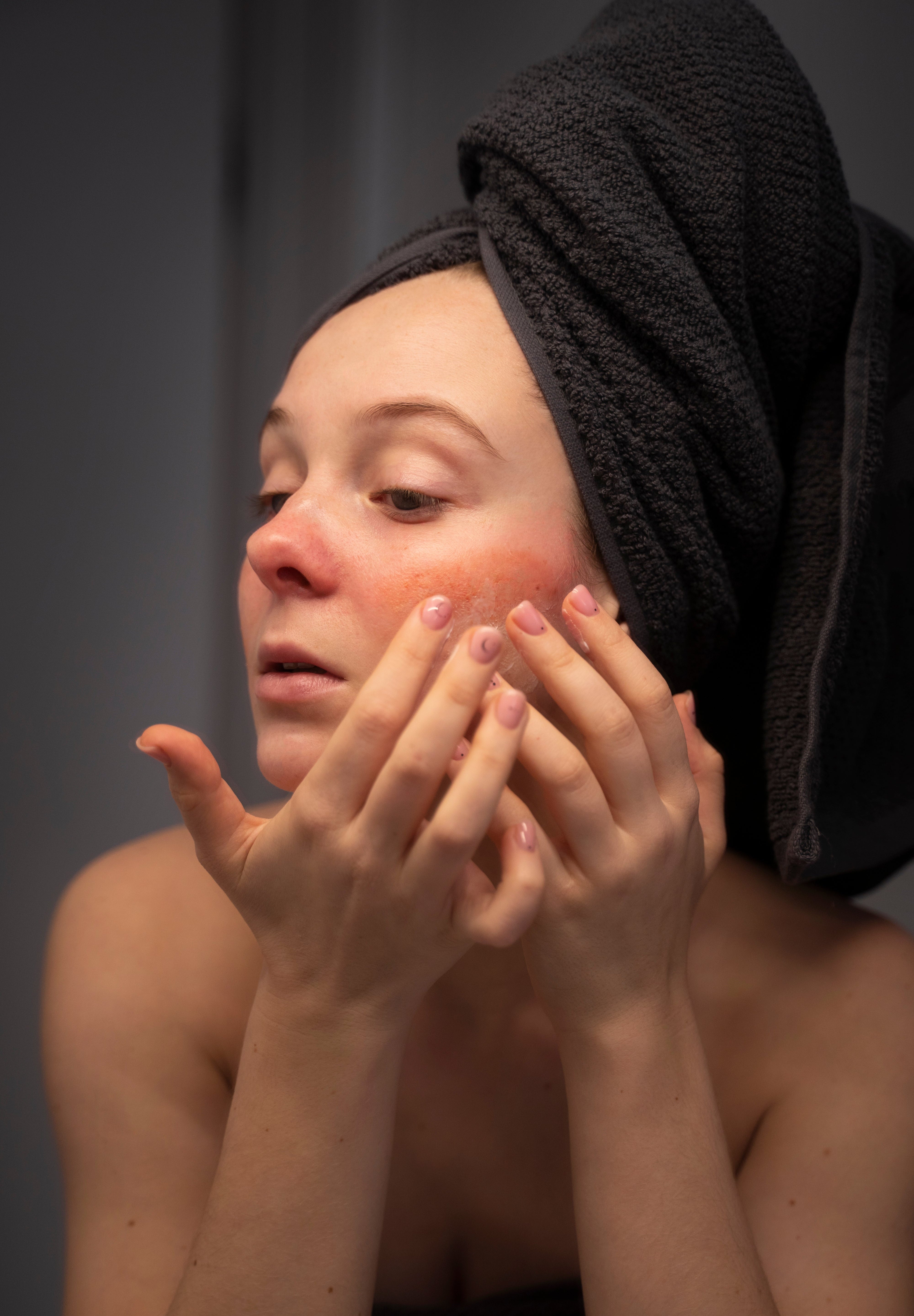 How to Soothe Dry Patches on Your Face in Winter: Expert Tips and Skyn Iceland Solutions