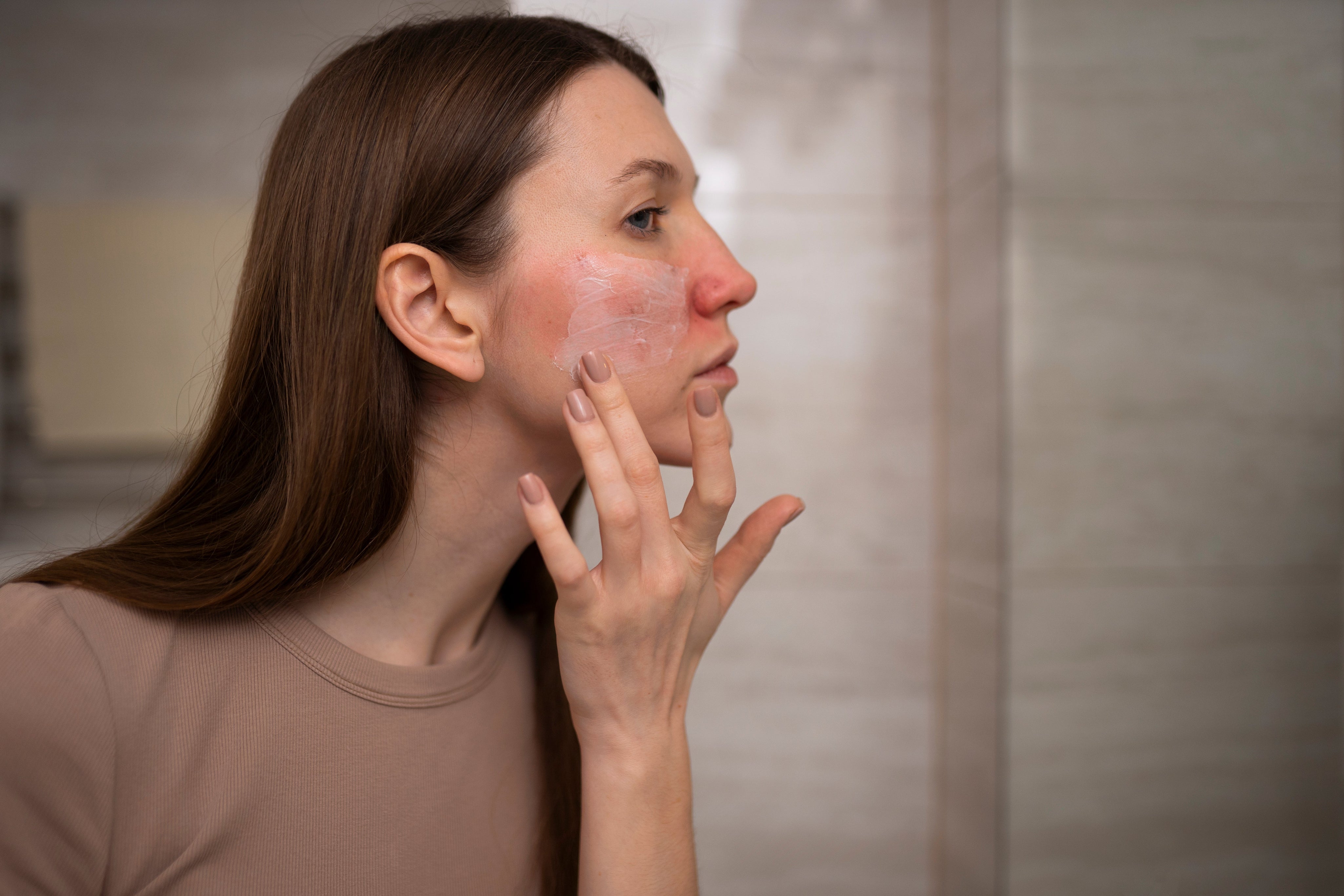 How to Repair a Damaged Skin Barrier (And What to Use from Skyn Iceland)