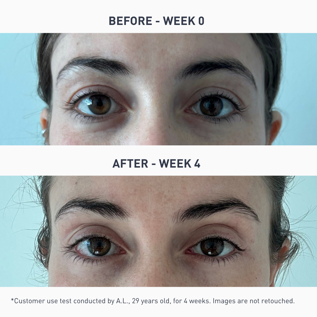 Brightening Eye Serum - 0.5 oz