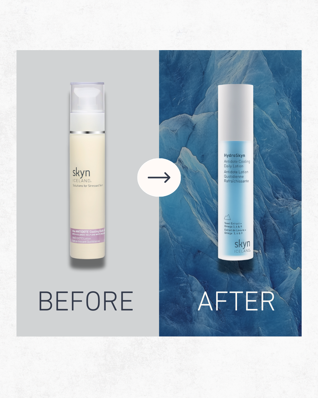 Two vertical skincare bottles side by side with text "before" under a beige pump bottle and "after" under a slim blue bottle