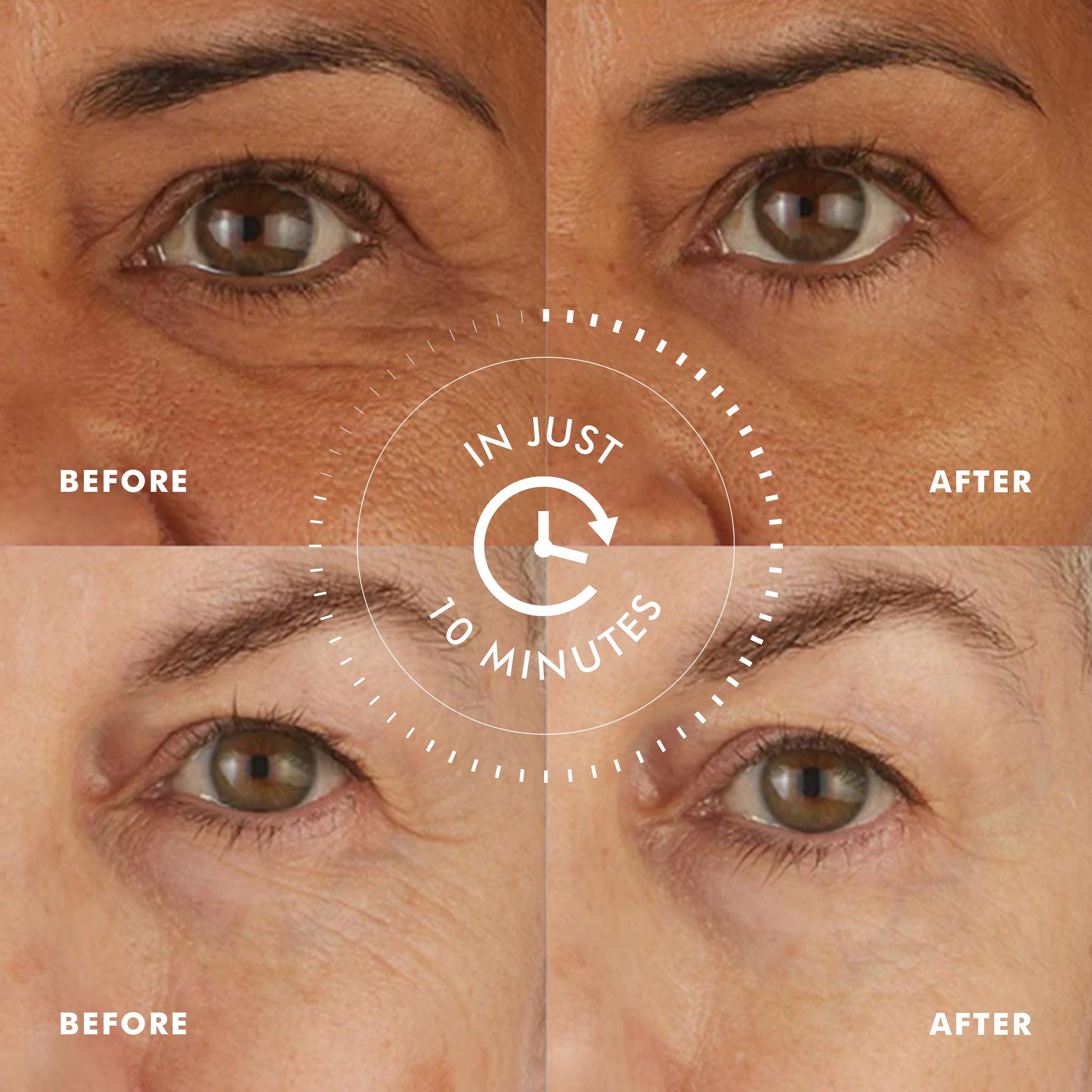Before and after close-ups showing reduced wrinkles and firmer skin around eyes after 10 minutes using Hydro Cool Firming.